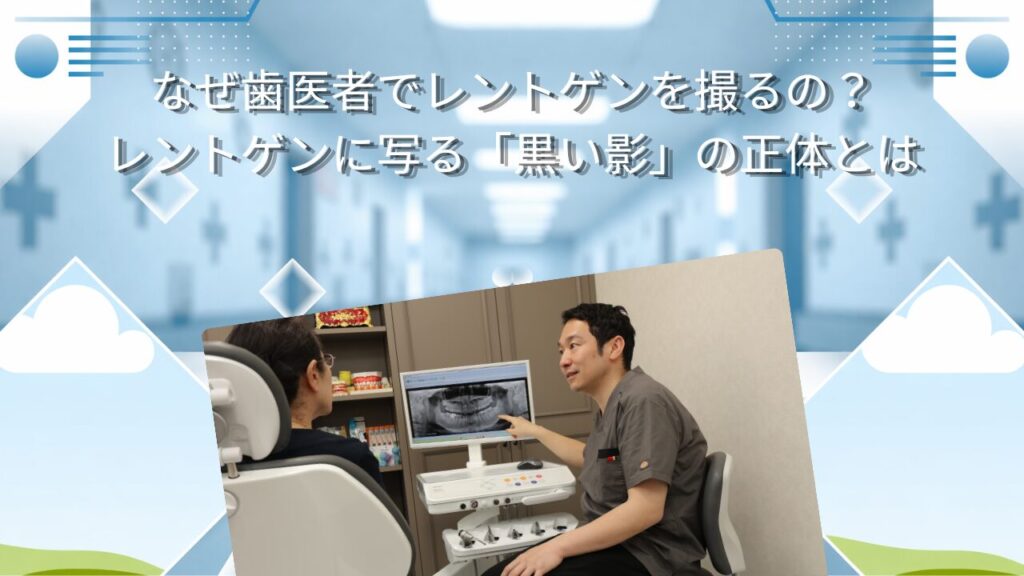 なぜ歯医者でレントゲンを撮るの？レントゲンに写る「黒い影」の正体とは