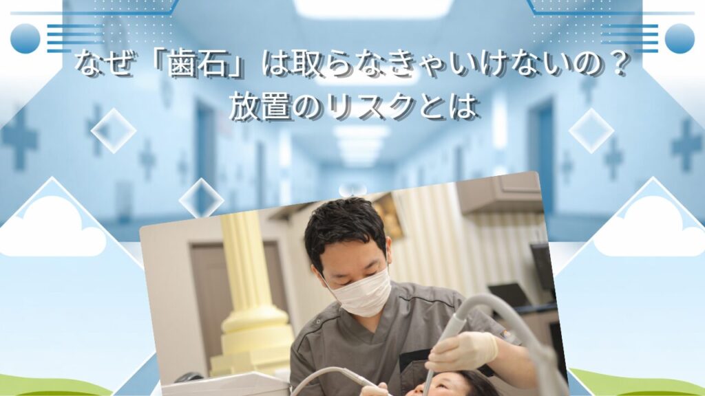 なぜ「歯石」は取らなきゃいけないの？放置のリスクとは