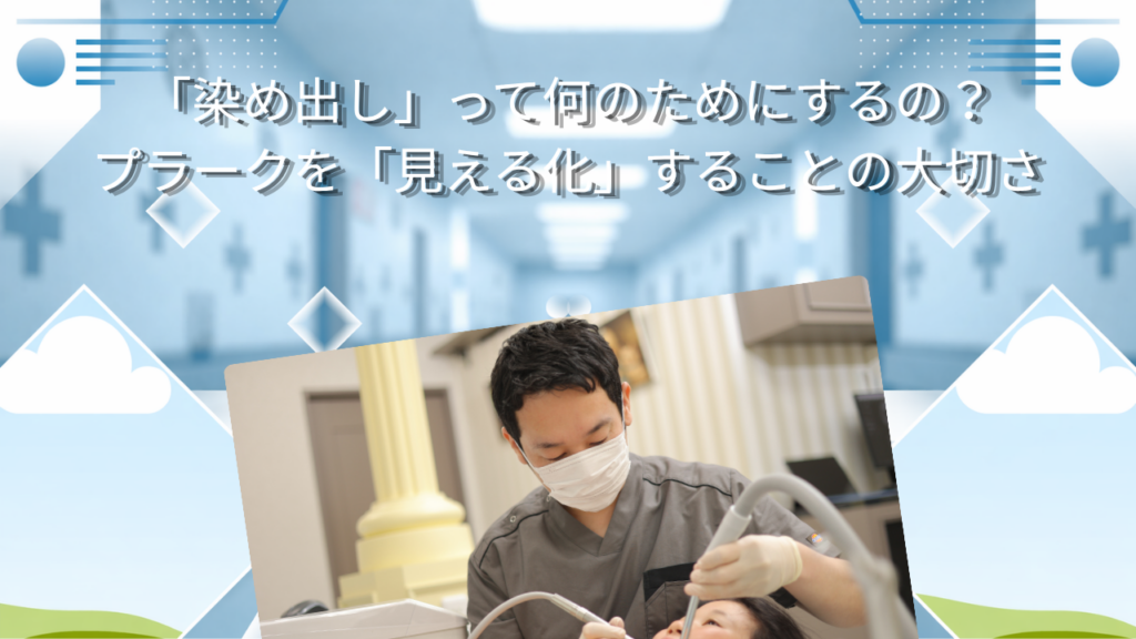 「染め出し」って何のためにするの？　プラークを「見える化」することの大切さ