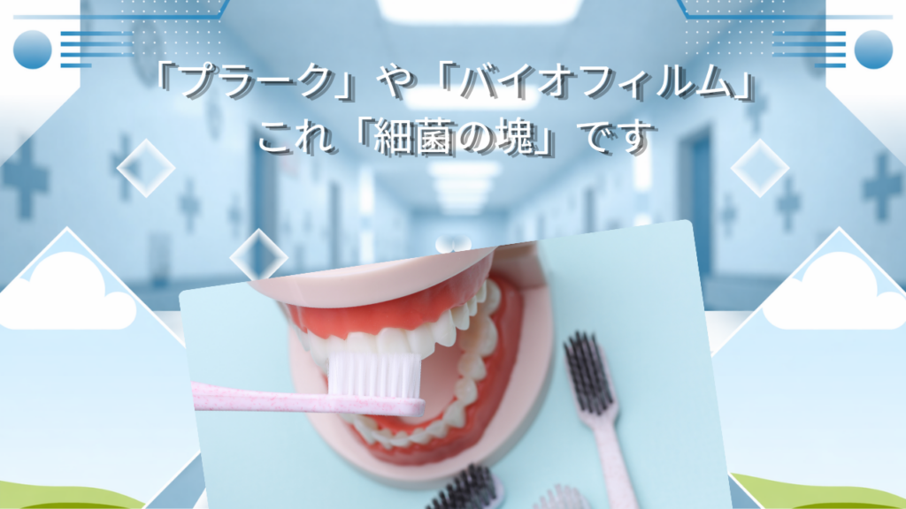 「プラーク」や「バイオフィルム」　これ「細菌の塊」です